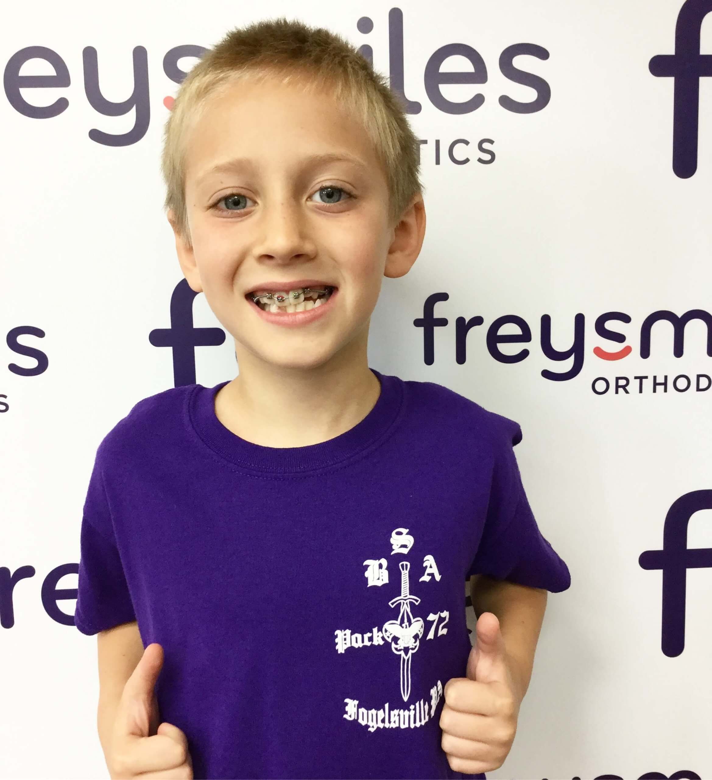 A little boy with braces smiles and gives thumbs up